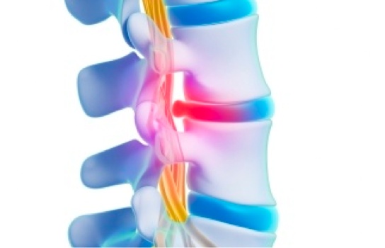 Spine/Back Surgery